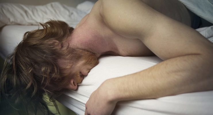 Man in bed looking despondent